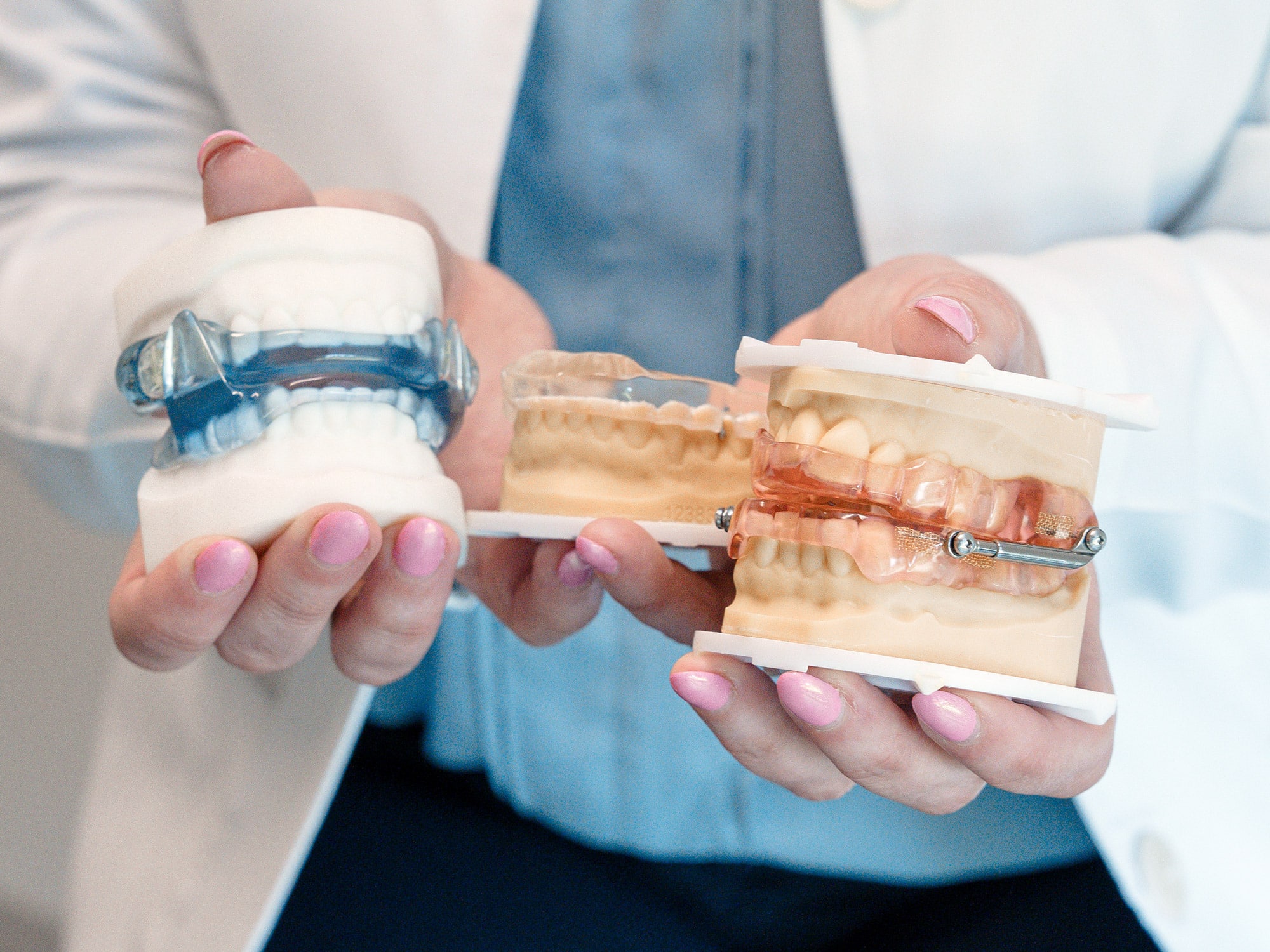 A person holding three dental models featuring orthodontic appliances. The models display different types of braces designed for teeth alignment correction and oral health.