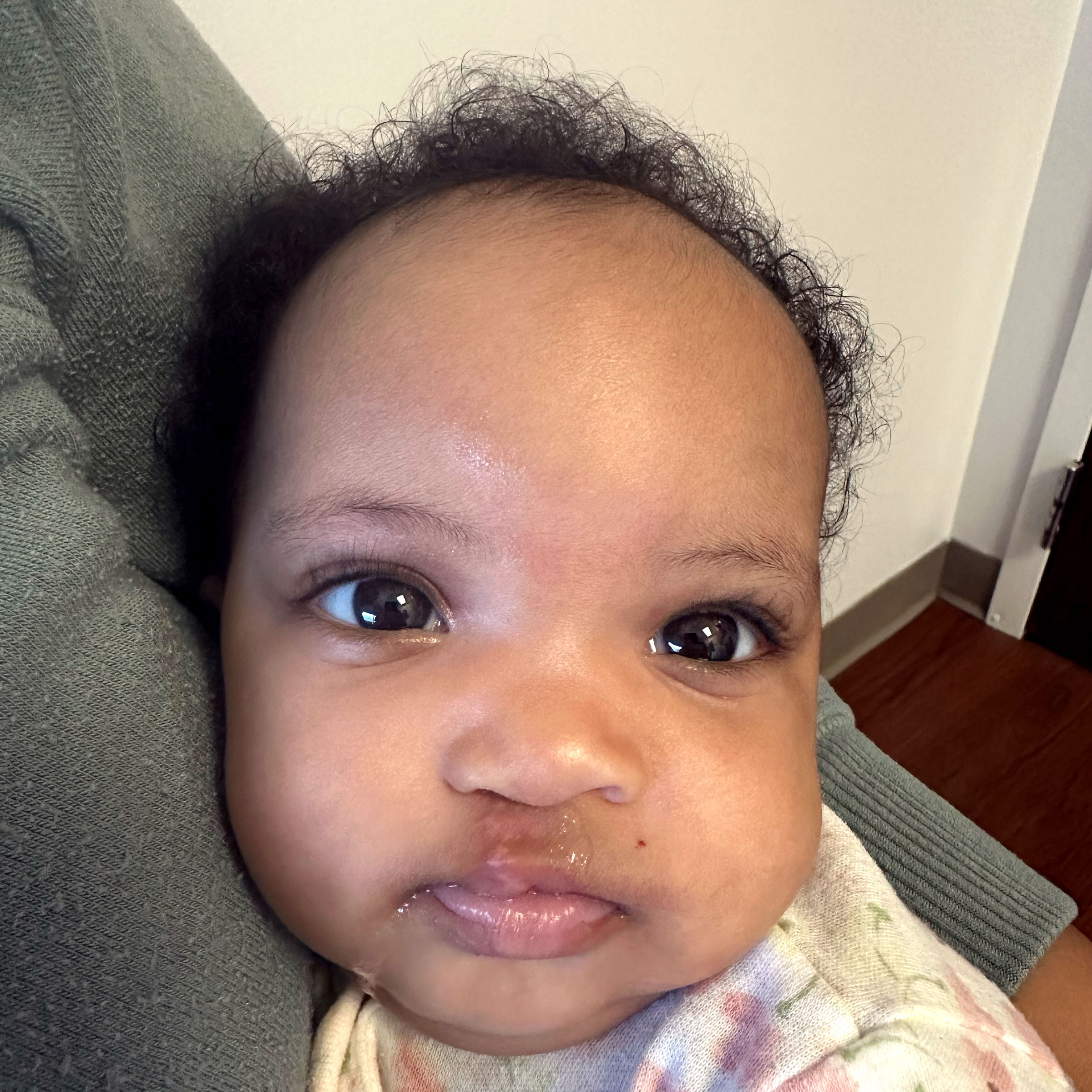 Cleft & Craniofacial Patient Transformation - after