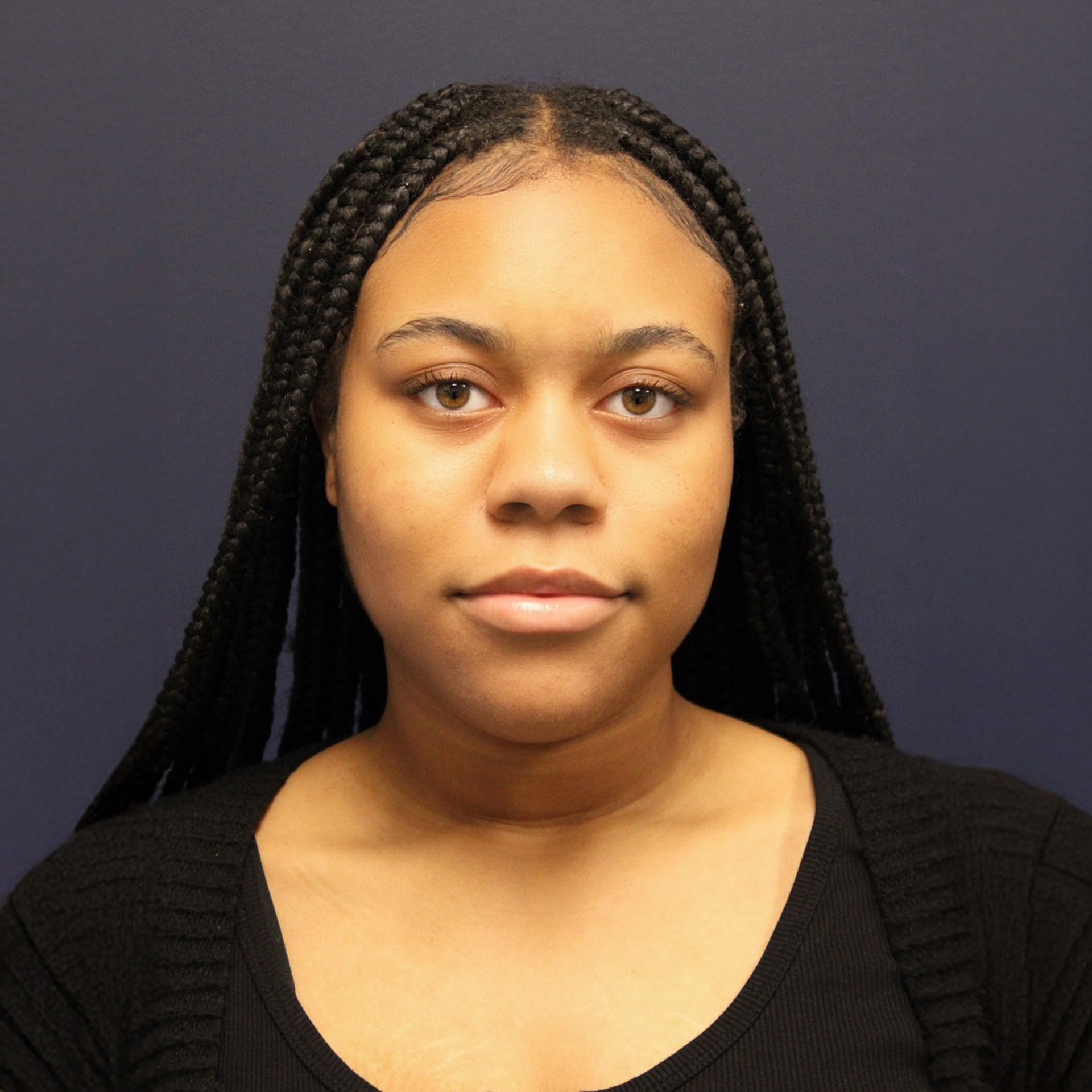 Jaw Surgery Before: Dr. Roger Moreira - CCOFS - Raleigh, NC